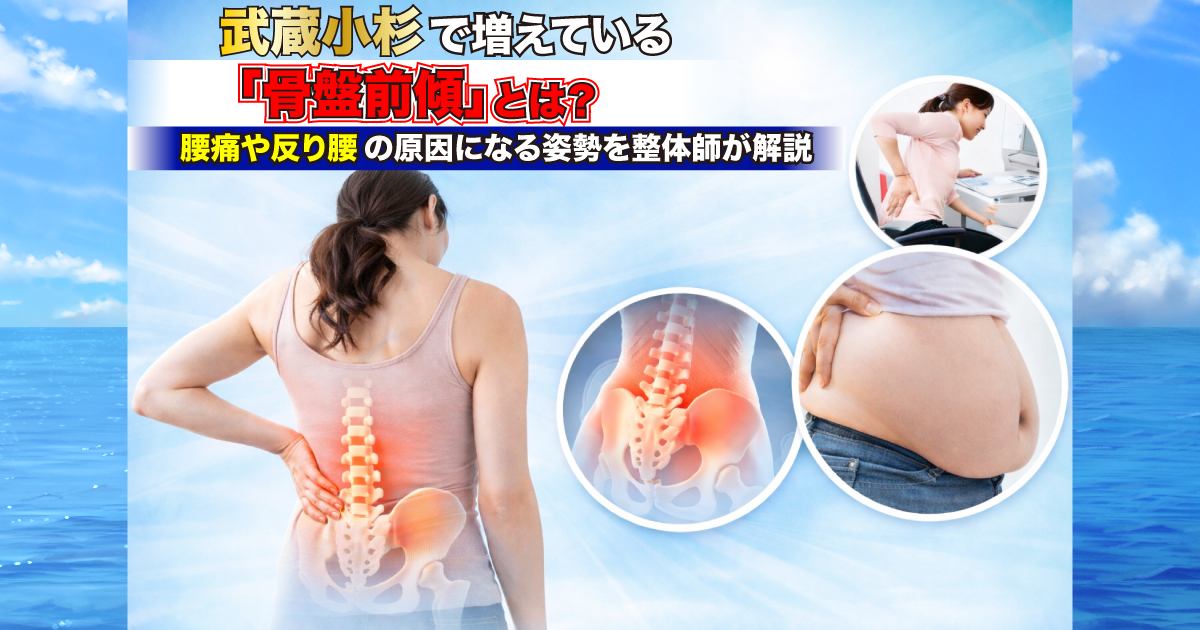 武蔵小杉で増えている「骨盤前傾」とは？腰痛や反り腰の原因になる姿勢を整体が解説